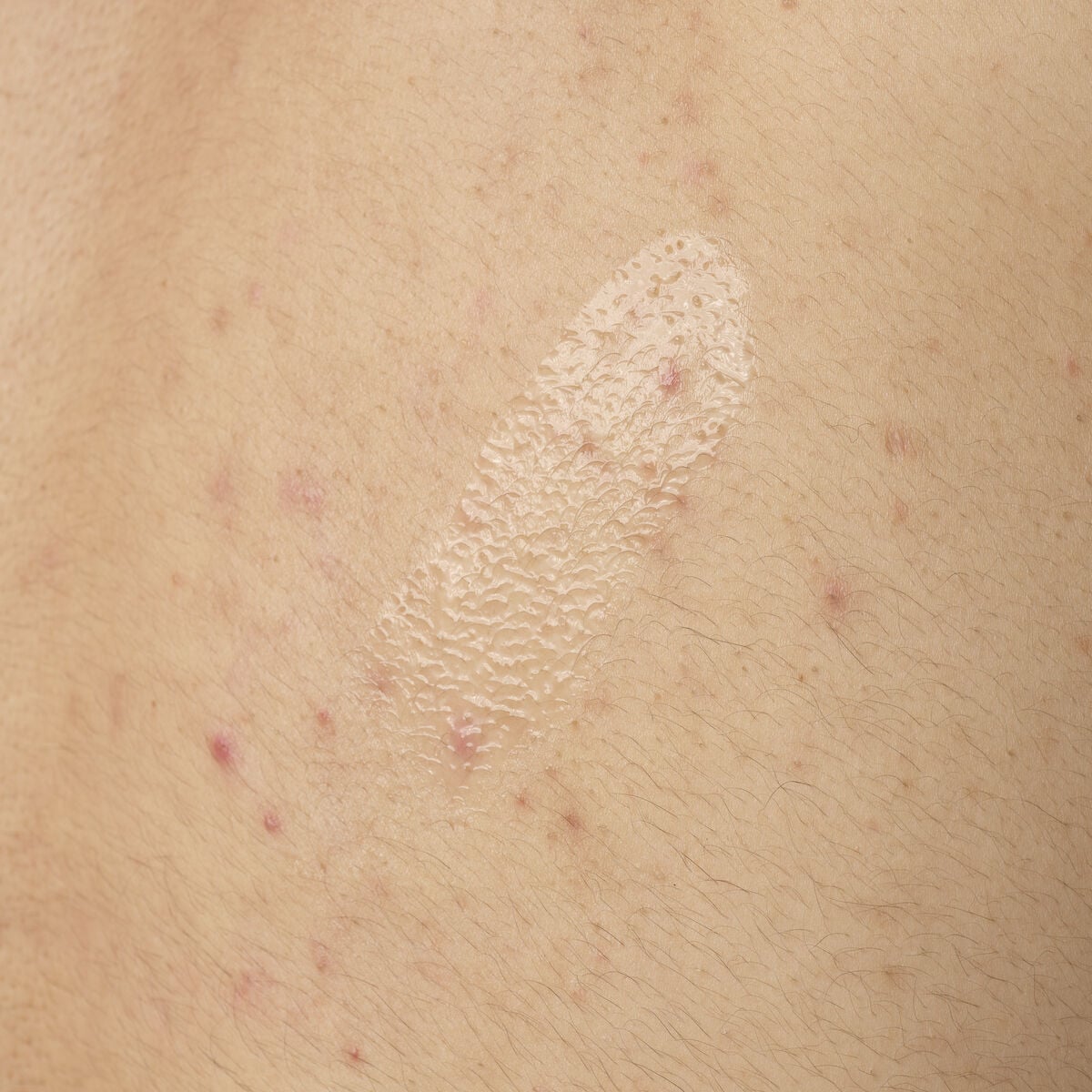 salicylic-acid-0-5-body-serum-y7 ORD-salicylic-acid-05-body-240ml-application.jpg