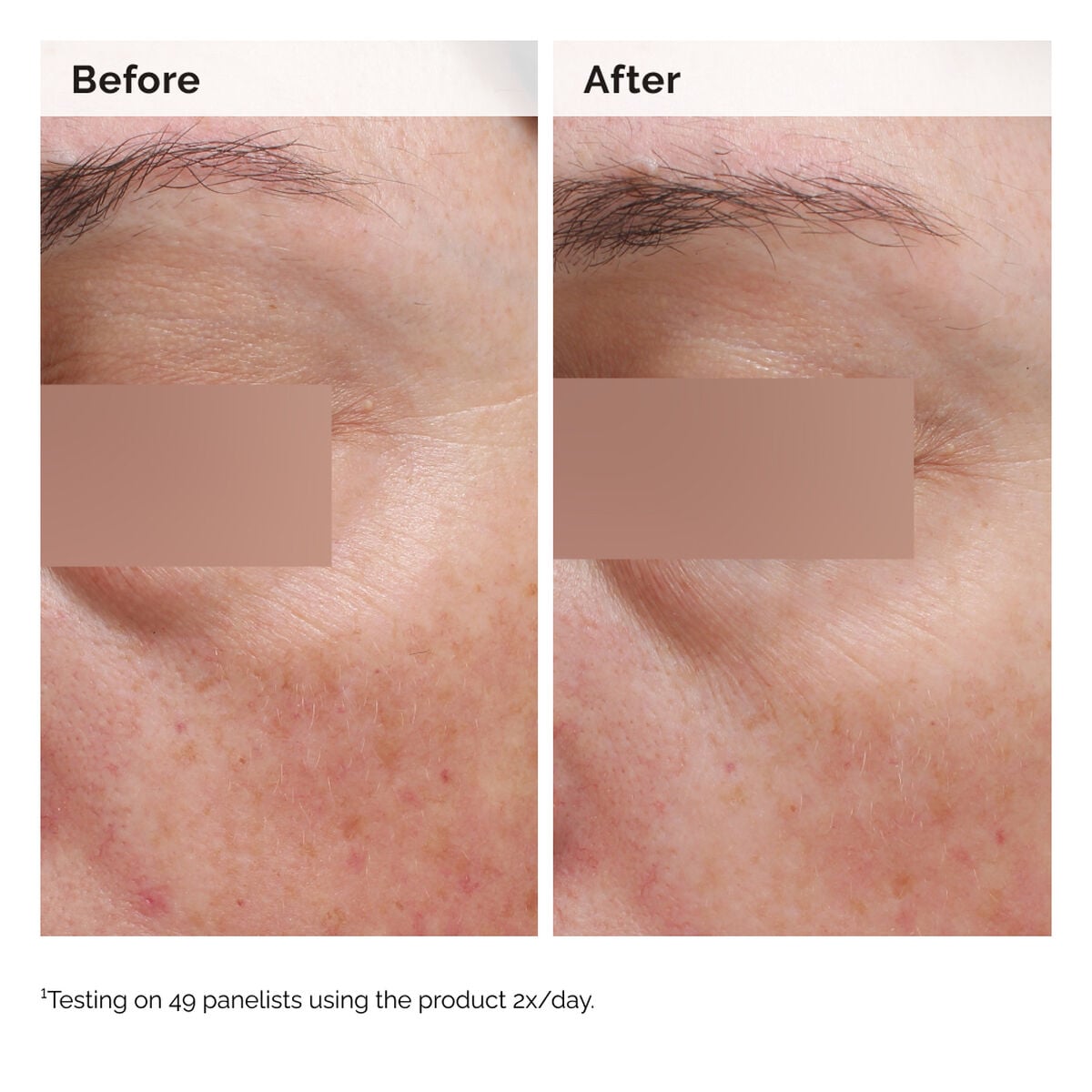 niacinamide-5-face-and-body-emulsion-u5 2024-08-23-ORD-Nia-5pct-Face-Body-B-A-Elasticity-Global-02-1x1.jpg