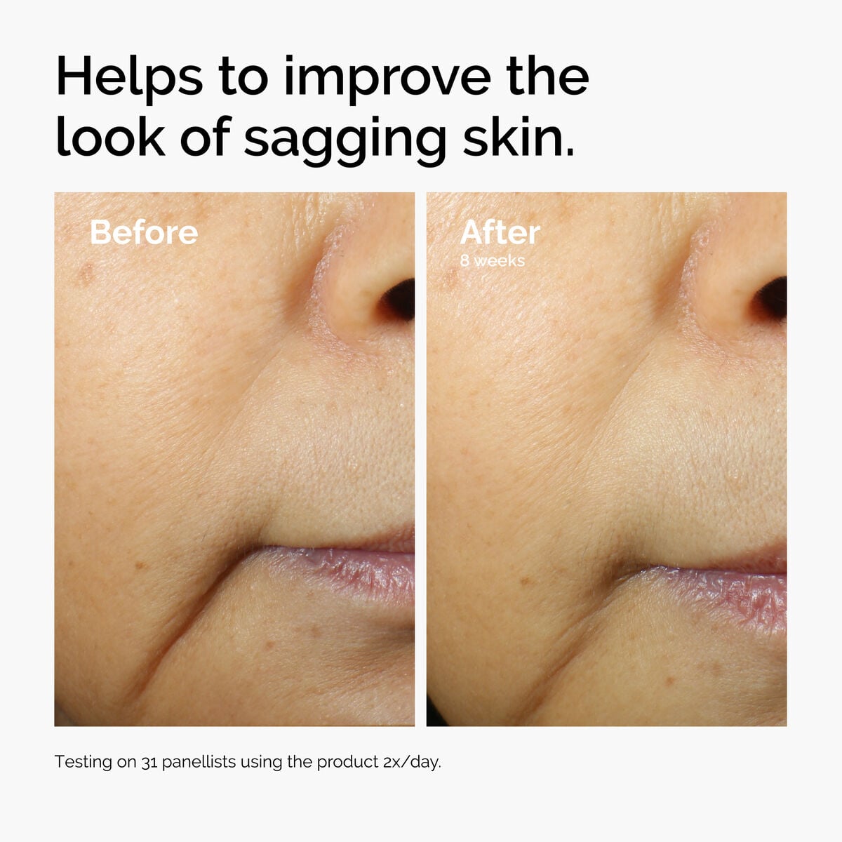 caffeine-3-escin-1-face-serum-p9 ord-caffeine-3pct-escin-1pct-face-serum-before-after-sagging.jpg