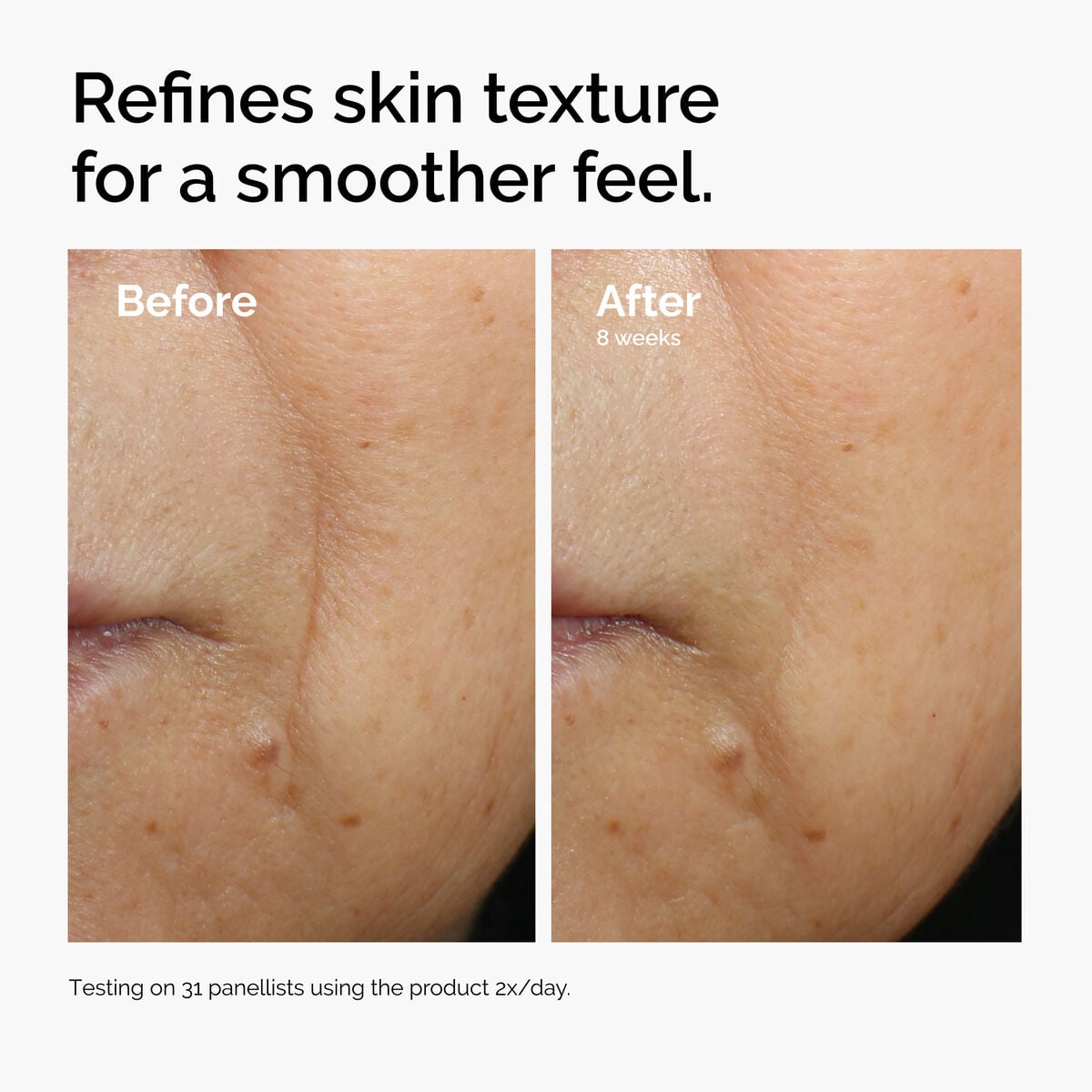 caffeine-3-escin-1-face-serum-p9 ord-caffeine-3pct-escin-1pct-face-serum-before-after-texture.jpg