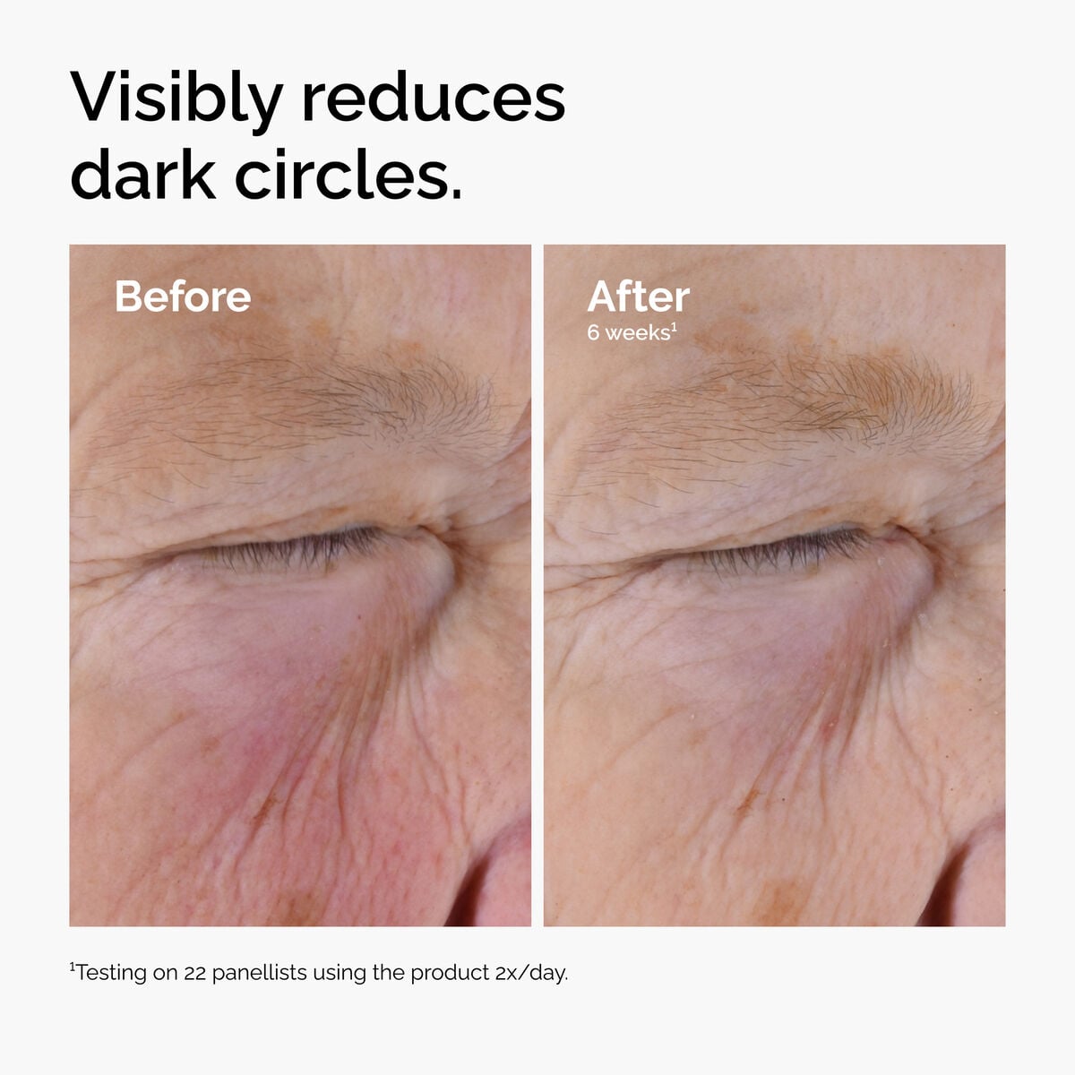 caffeine-solution-5-egcg-eye-serum-q9 ord-caffeine-solution-egcg-dark-circles-before-after.jpg