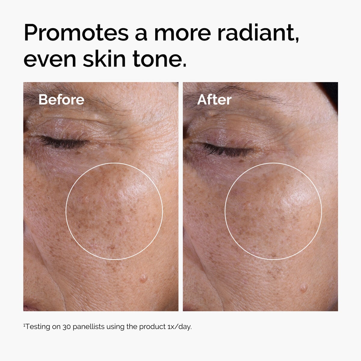 glycolic-acid-7-exfoliating-toner-t8 ord-glycolic-before-after-radiance.jpg