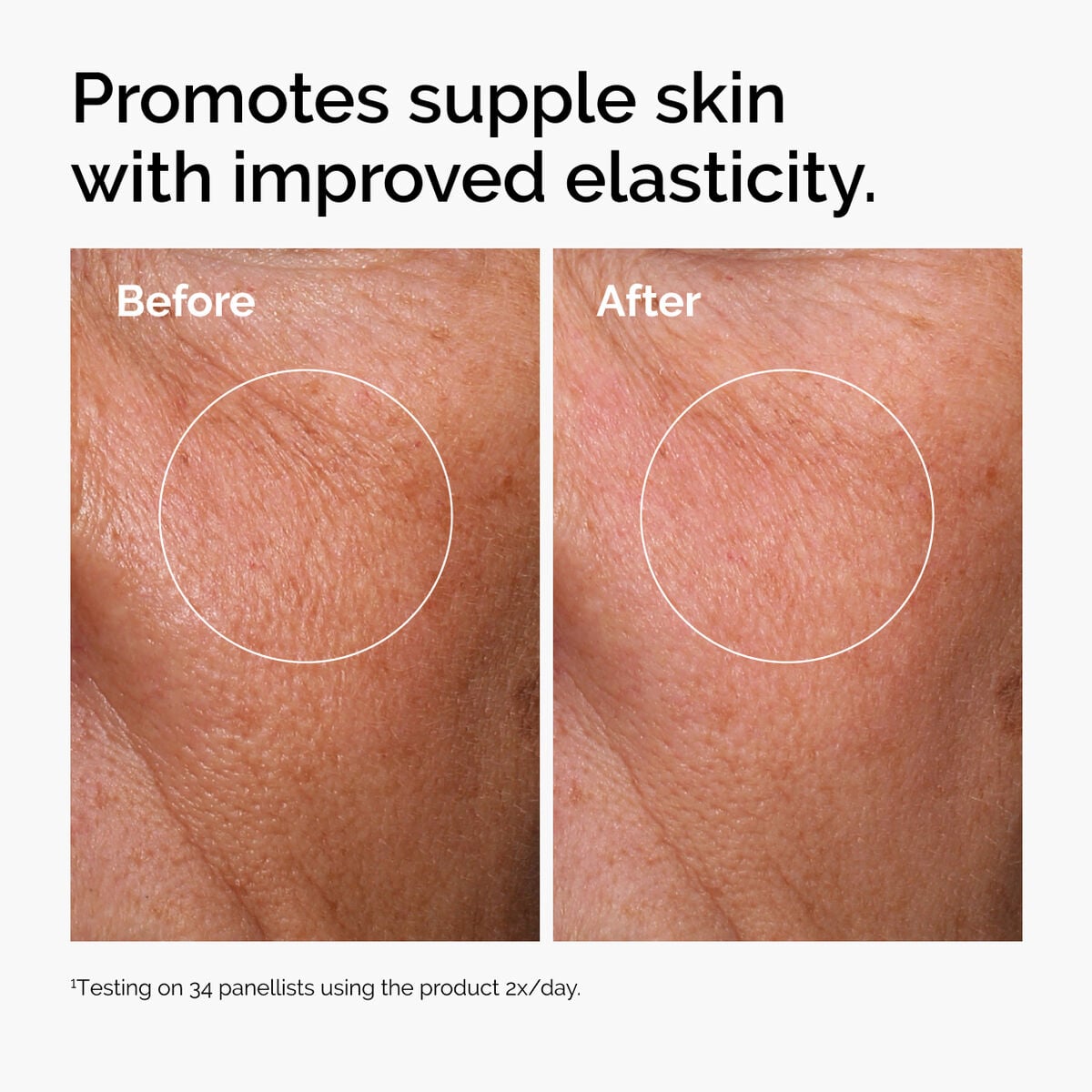 hyaluronic-acid-2-b5-with-ceramides-j3 ord-hyaluronic-acid-2pct-b5-hydrating-serum-before-after-elasticity.jpg