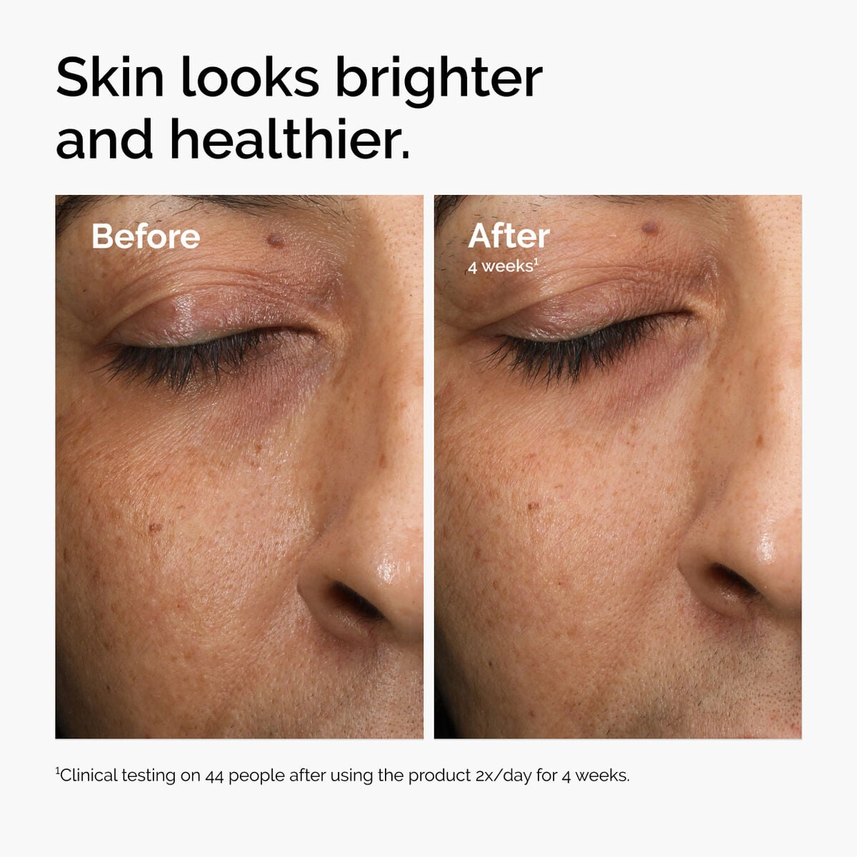 multi-antioxidant-radiance-serum-c1 ord-mars-before-after-healthy.jpg