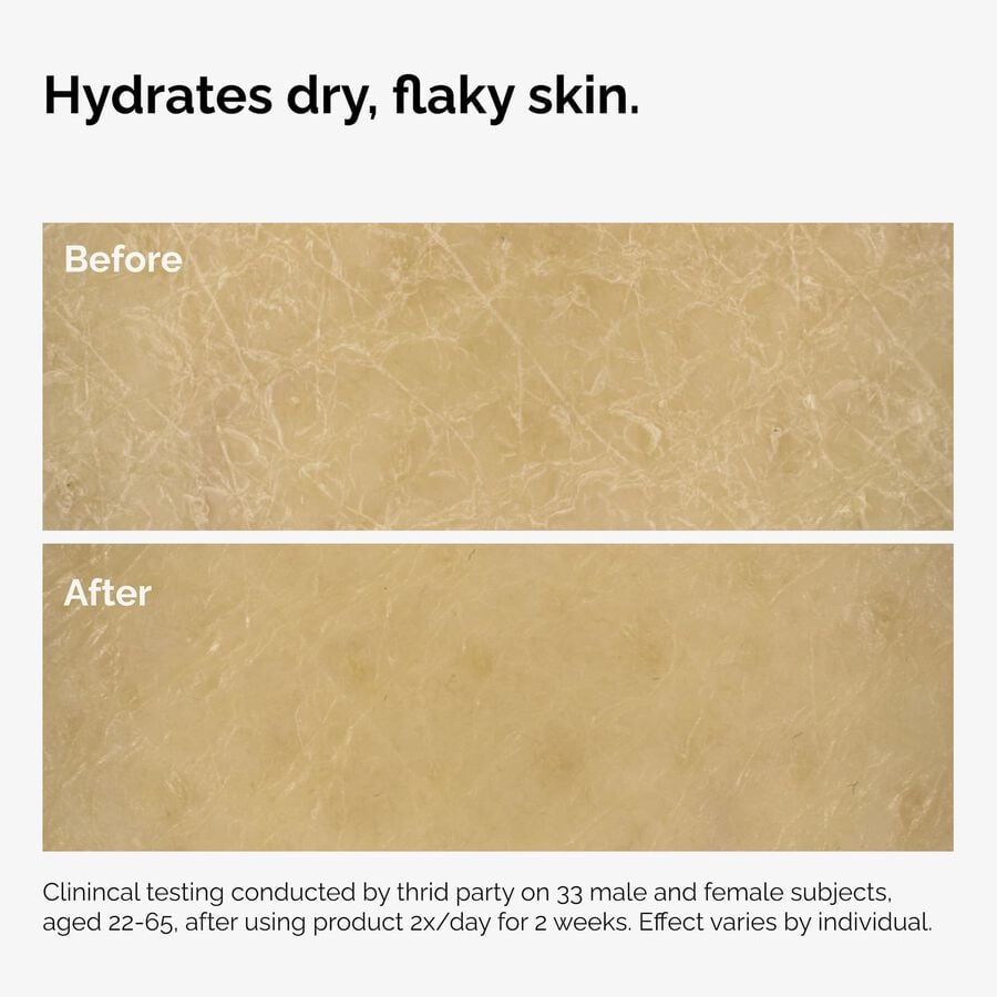 the-body-care-collection-v9 ord-natural-moisturizing-factors-inulin-body-before-after-graphic-02.jpg