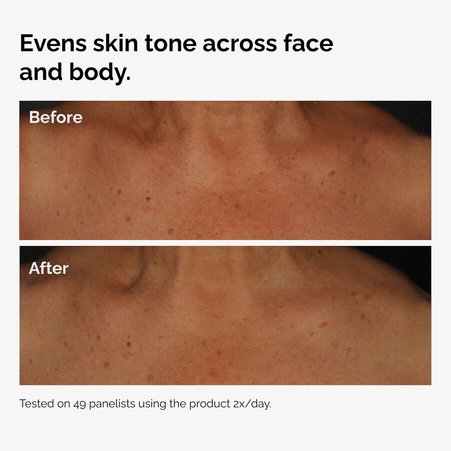 the-body-care-collection-v9 ord-niacinamide-face-body-serum-before-after-even-tone-graphic.jpg