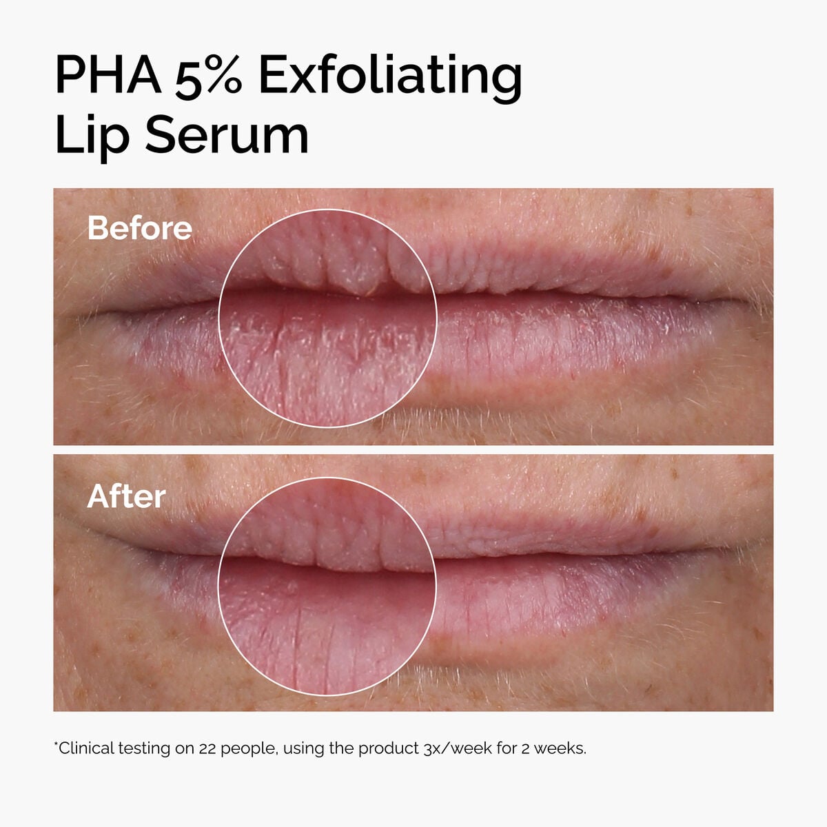 pha-5-exfoliating-lip-serum-n0 ord-pha-5pct-lip-exfoliating-serum-before-after.jpg